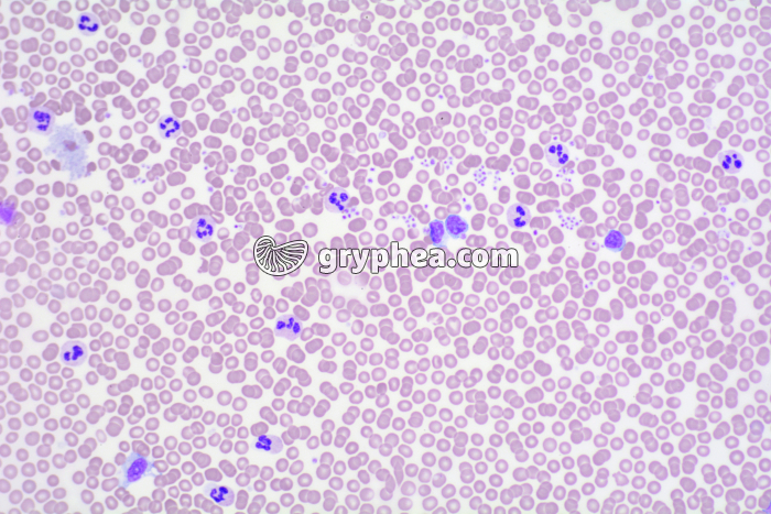 Sang septicémie x100 - gryphea.org